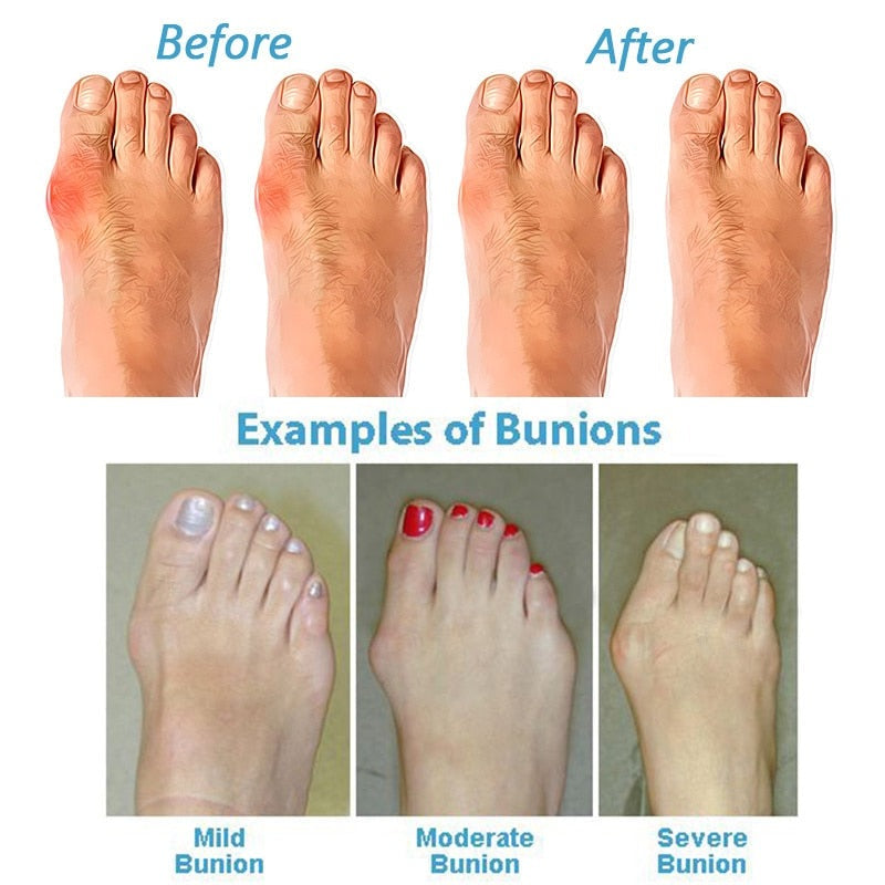 Suki Collection | Women's Sandals with Orthopedic Support | Cushioned Comfort for Bunion Relief